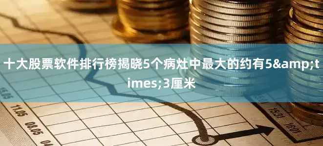 十大股票软件排行榜揭晓5个病灶中最大的约有5&times;3厘米